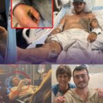 Hunter Alexander was under surgical lights as doctors fought to save his hand after a devastating electrical injury. Multiple surgeries, swelling, wound care, and constant monitoring followed. Circulation was fragile. Infection was a constant threat. Every hour felt uncertain. 1687