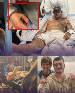 Hunter Alexander was under surgical lights as doctors fought to save his hand after a devastating electrical injury. Multiple surgeries, swelling, wound care, and constant monitoring followed. Circulation was fragile. Infection was a constant threat. Every hour felt uncertain.